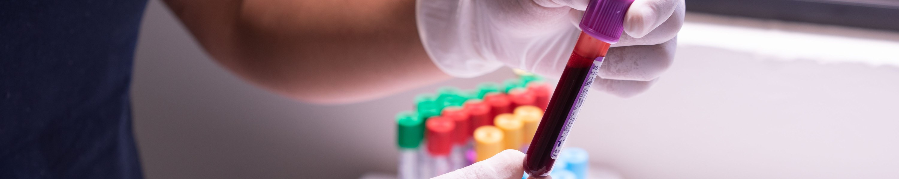 Fohlenaufzucht: Skelettaufbau, Calcium Phosphor Verhältnis und Mineralien richtig dosieren