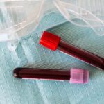 Vitamin E und Selen beim Pferd: Muskelregeneration, antioxidativer Zellschutz und Mangelerscheinungen